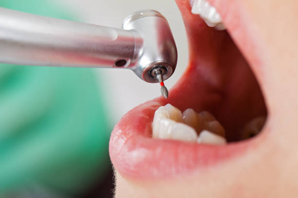 Emergency Gum Pain Relief in IN